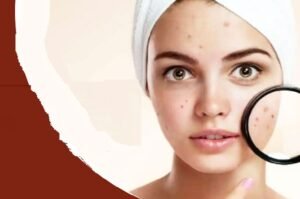 00000000000000000000000000000-1