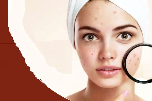 00000000000000000000000000000-1