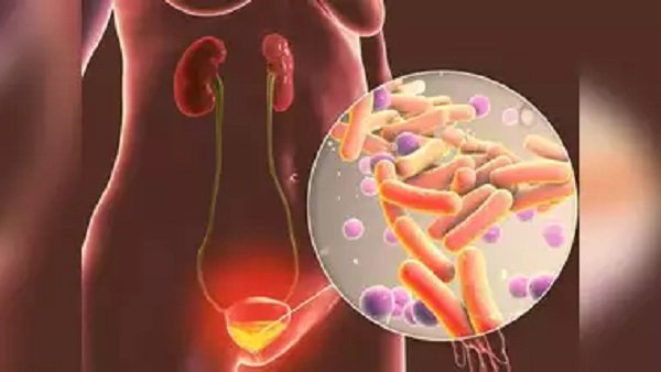 UTI-Infection
