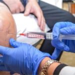 2026_9image_12_28_547330732stemcelltherapy-ll